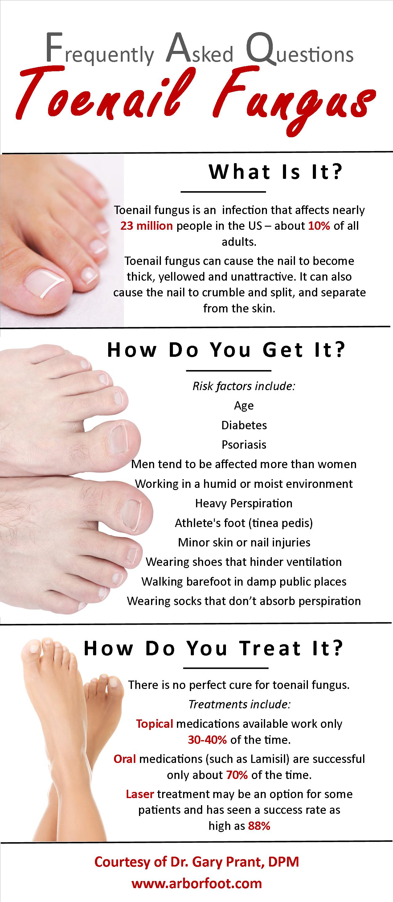 FAQ Toenail Fungus