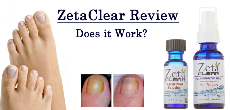 toenail fungus review